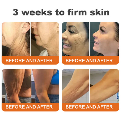 💫Made and Shipped from US Rolimey® Argireline-infused Bee Venom Firming Serum Stick(⏳LAST DAY 70% OFF)✨