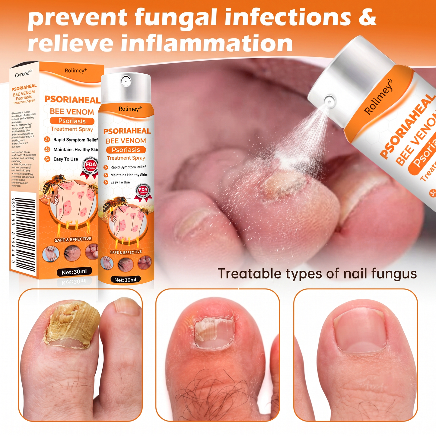 Rolimey® PsoriaHeal Bee Venom Psoriasis Treatment Spray(Suitable for all skin conditions)