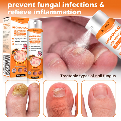 Rolimey® PsoriaHeal Bee Venom Psoriasis Treatment Spray(Suitable for all skin conditions)