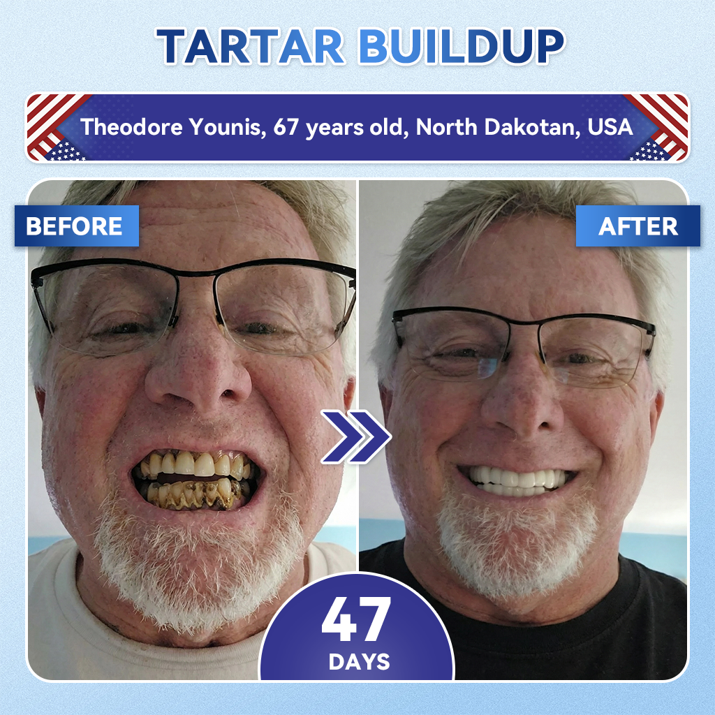 Smile instantly 🦷 GFOUK®⭐⭐ 𝑇𝑖𝑑𝑒𝑔𝑙𝑢𝑠𝑖𝑏 𝑇𝑜𝑜𝑡ℎ & 𝐺𝑢𝑚 𝑅𝑒𝑝𝑎𝑖𝑟 𝐹𝑎𝑠𝑡-𝐷𝑖𝑠𝑠𝑜𝑙𝑣𝑖𝑛𝑔 𝑊ℎ𝑖𝑡𝑒𝑛𝑖𝑛𝑔 𝑆𝑡𝑟𝑖𝑝𝑠  (𝟓-𝐢𝐧-𝟏 💎 𝐑𝐞𝐛𝐮𝐢𝐥𝐝 𝐄𝐧𝐚𝐦𝐞𝐥 & 𝐃𝐞𝐧𝐭𝐢𝐧 • 𝐒𝐭𝐫𝐞𝐧𝐠𝐭𝐡𝐞𝐧 𝐆𝐮𝐦𝐬 • 𝐄𝐫𝐚𝐝𝐢𝐜𝐚𝐭𝐞 𝐓𝐚𝐫𝐭𝐚𝐫 & 𝐎𝐝𝐨𝐫 • 𝐖𝐡𝐢𝐭𝐞𝐧𝐢𝐧𝐠 • 𝐒𝐭𝐨𝐩 𝐓𝐨𝐨𝐭𝐡 𝐒𝐞𝐧𝐬𝐢𝐭𝐢𝐯𝐢𝐭𝐲)