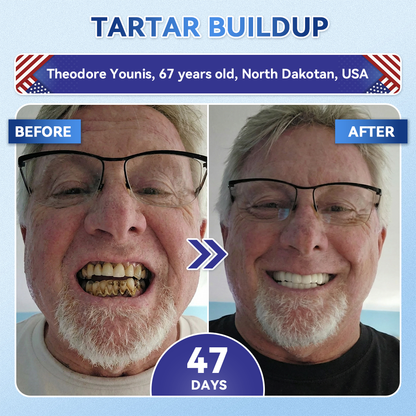 Smile instantly 🦷 GFOUK®⭐⭐ 𝑇𝑖𝑑𝑒𝑔𝑙𝑢𝑠𝑖𝑏 𝑇𝑜𝑜𝑡ℎ & 𝐺𝑢𝑚 𝑅𝑒𝑝𝑎𝑖𝑟 𝐹𝑎𝑠𝑡-𝐷𝑖𝑠𝑠𝑜𝑙𝑣𝑖𝑛𝑔 𝑊ℎ𝑖𝑡𝑒𝑛𝑖𝑛𝑔 𝑆𝑡𝑟𝑖𝑝𝑠  (𝟓-𝐢𝐧-𝟏 💎 𝐑𝐞𝐛𝐮𝐢𝐥𝐝 𝐄𝐧𝐚𝐦𝐞𝐥 & 𝐃𝐞𝐧𝐭𝐢𝐧 • 𝐒𝐭𝐫𝐞𝐧𝐠𝐭𝐡𝐞𝐧 𝐆𝐮𝐦𝐬 • 𝐄𝐫𝐚𝐝𝐢𝐜𝐚𝐭𝐞 𝐓𝐚𝐫𝐭𝐚𝐫 & 𝐎𝐝𝐨𝐫 • 𝐖𝐡𝐢𝐭𝐞𝐧𝐢𝐧𝐠 • 𝐒𝐭𝐨𝐩 𝐓𝐨𝐨𝐭𝐡 𝐒𝐞𝐧𝐬𝐢𝐭𝐢𝐯𝐢𝐭𝐲)