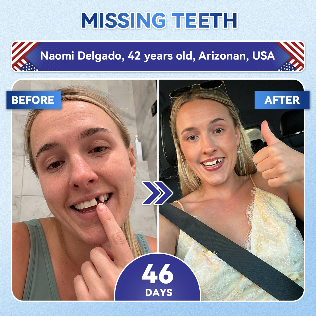 Smile instantly 🦷 GFOUK®⭐⭐ 𝑇𝑖𝑑𝑒𝑔𝑙𝑢𝑠𝑖𝑏 𝑇𝑜𝑜𝑡ℎ & 𝐺𝑢𝑚 𝑅𝑒𝑝𝑎𝑖𝑟 𝐹𝑎𝑠𝑡-𝐷𝑖𝑠𝑠𝑜𝑙𝑣𝑖𝑛𝑔 𝑊ℎ𝑖𝑡𝑒𝑛𝑖𝑛𝑔 𝑆𝑡𝑟𝑖𝑝𝑠  (𝟓-𝐢𝐧-𝟏 💎 𝐑𝐞𝐛𝐮𝐢𝐥𝐝 𝐄𝐧𝐚𝐦𝐞𝐥 & 𝐃𝐞𝐧𝐭𝐢𝐧 • 𝐒𝐭𝐫𝐞𝐧𝐠𝐭𝐡𝐞𝐧 𝐆𝐮𝐦𝐬 • 𝐄𝐫𝐚𝐝𝐢𝐜𝐚𝐭𝐞 𝐓𝐚𝐫𝐭𝐚𝐫 & 𝐎𝐝𝐨𝐫 • 𝐖𝐡𝐢𝐭𝐞𝐧𝐢𝐧𝐠 • 𝐒𝐭𝐨𝐩 𝐓𝐨𝐨𝐭𝐡 𝐒𝐞𝐧𝐬𝐢𝐭𝐢𝐯𝐢𝐭𝐲)