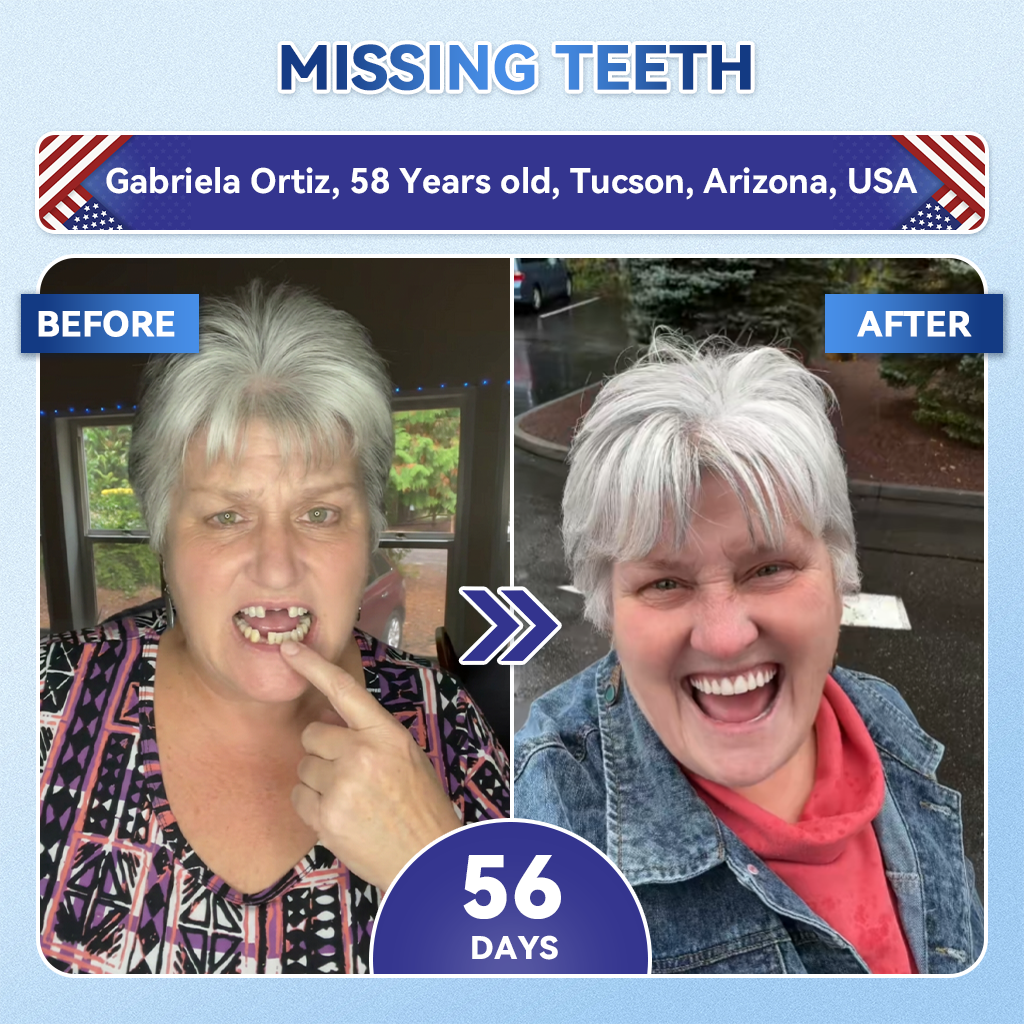 Smile instantly 🦷 GFOUK®⭐⭐ 𝑇𝑖𝑑𝑒𝑔𝑙𝑢𝑠𝑖𝑏 𝑇𝑜𝑜𝑡ℎ & 𝐺𝑢𝑚 𝑅𝑒𝑝𝑎𝑖𝑟 𝐹𝑎𝑠𝑡-𝐷𝑖𝑠𝑠𝑜𝑙𝑣𝑖𝑛𝑔 𝑊ℎ𝑖𝑡𝑒𝑛𝑖𝑛𝑔 𝑆𝑡𝑟𝑖𝑝𝑠  (𝟓-𝐢𝐧-𝟏 💎 𝐑𝐞𝐛𝐮𝐢𝐥𝐝 𝐄𝐧𝐚𝐦𝐞𝐥 & 𝐃𝐞𝐧𝐭𝐢𝐧 • 𝐒𝐭𝐫𝐞𝐧𝐠𝐭𝐡𝐞𝐧 𝐆𝐮𝐦𝐬 • 𝐄𝐫𝐚𝐝𝐢𝐜𝐚𝐭𝐞 𝐓𝐚𝐫𝐭𝐚𝐫 & 𝐎𝐝𝐨𝐫 • 𝐖𝐡𝐢𝐭𝐞𝐧𝐢𝐧𝐠 • 𝐒𝐭𝐨𝐩 𝐓𝐨𝐨𝐭𝐡 𝐒𝐞𝐧𝐬𝐢𝐭𝐢𝐯𝐢𝐭𝐲)