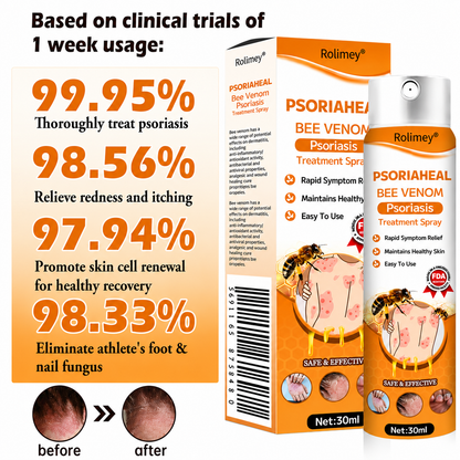 Rolimey® PsoriaHeal Bee Venom Psoriasis Treatment Spray(Suitable for all skin conditions)
