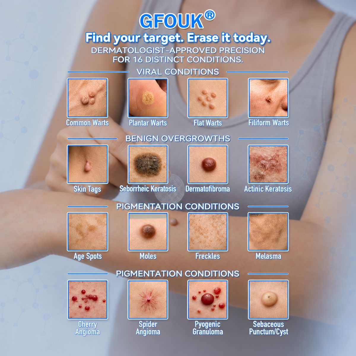 🔥𝐎𝐟𝐟𝐢𝐜𝐢𝐚𝐥 𝐒𝐭𝐨𝐫𝐞 | GFOUK® 🌿𝐁𝐨𝐭𝐚𝐧𝐢𝐜𝐚𝐥 𝐌𝐢𝐜𝐫𝐨𝐧𝐞𝐞𝐝𝐥𝐞 𝐇𝐲𝐝𝐫𝐨𝐜𝐨𝐥𝐥𝐨𝐢𝐝 𝐏𝐚𝐭𝐜𝐡 (𝐅𝐨𝐫 𝐒𝐤𝐢𝐧 𝐓𝐚𝐠𝐬, 𝐒𝐦𝐚𝐥𝐥 𝐒𝐤𝐢𝐧 𝐆𝐫𝐨𝐰𝐭𝐡𝐬, 𝐖𝐚𝐫𝐭𝐬, 𝐌𝐨𝐥𝐞𝐬, 𝐀𝐠𝐞 𝐒𝐩𝐨𝐭𝐬 & 𝐏𝐢𝐠𝐦𝐞𝐧𝐭𝐚𝐭𝐢𝐨𝐧 𝐂𝐨𝐧𝐜𝐞𝐫𝐧𝐬)