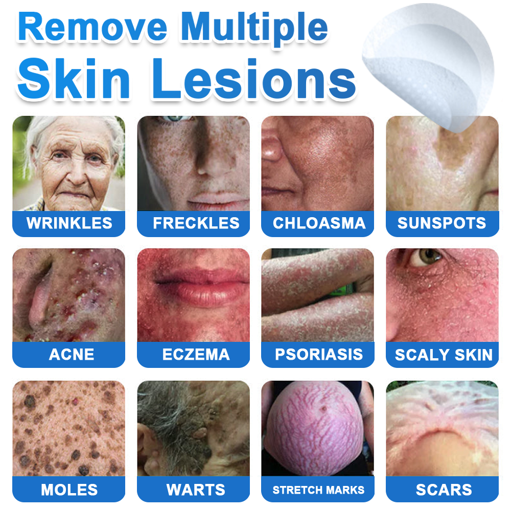 🆕GFOUK® 2026 Newly Upgraded 2-in-1 Microneedle Hydrocolloid Patches | Removes Raised Moles, Acne, Flat Warts, and Skin Tags | Improves Wrinkles, Scars, and Blemishes | Invisible Acne Patches for Face & Body