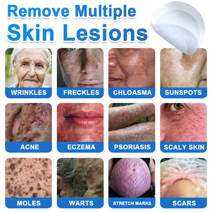 🆕GFOUK® 2026 Newly Upgraded 2-in-1 Microneedle Hydrocolloid Patches | Removes Raised Moles, Acne, Flat Warts, and Skin Tags | Improves Wrinkles, Scars, and Blemishes | Invisible Acne Patches for Face & Body