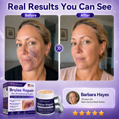💫Over 100,000 units sold💕 - Rolimey® cream to repair bruises and strengthen the skin