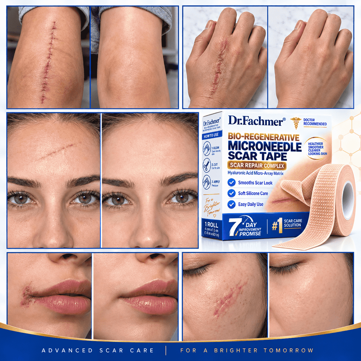 💫Dr.Fachmer® Bio-Regenerative Microneedle Scar Tape