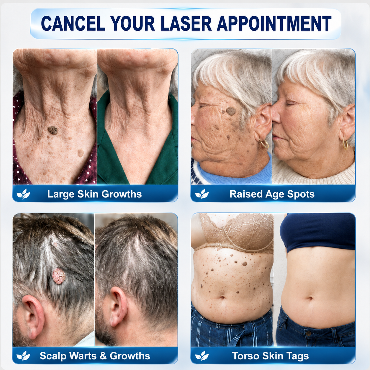 👨‍⚕️Official Brand Shop | 🔥Rolimey® 7-Day Roll-On for Skin Spots and Skin Tags – Pain-Free & Scar-Free