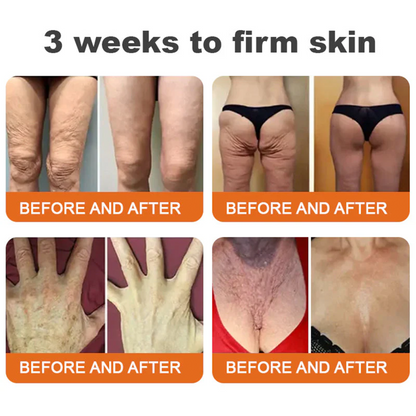 🌟💎 Rolimey® Bee venom Pro Comprehensive Cream —Tightening for Skin Types 🔥