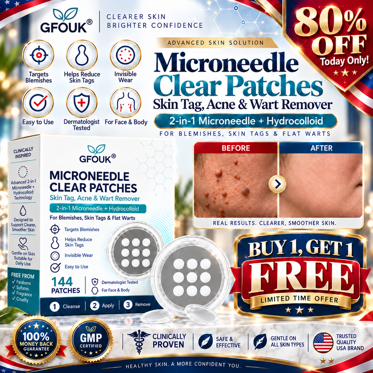 🧑‍⚕️𝐎𝐟𝐟𝐢𝐜𝐢𝐚𝐥 𝐒𝐭𝐨𝐫𝐞 | GFOUK®  🌿𝐁𝐨𝐭𝐚𝐧𝐢𝐜𝐚𝐥 𝐌𝐢𝐜𝐫𝐨𝐧𝐞𝐞𝐝𝐥𝐞 𝐇𝐲𝐝𝐫𝐨𝐜𝐨𝐥𝐥𝐨𝐢𝐝 𝐏𝐚𝐭𝐜𝐡 (𝐅𝐨𝐫 𝐒𝐤𝐢𝐧 𝐓𝐚𝐠𝐬, 𝐒𝐦𝐚𝐥𝐥 𝐒𝐤𝐢𝐧 𝐆𝐫𝐨𝐰𝐭𝐡𝐬, 𝐖𝐚𝐫𝐭𝐬, 𝐌𝐨𝐥𝐞𝐬, 𝐀𝐠𝐞 𝐒𝐩𝐨𝐭𝐬 & 𝐏𝐢𝐠𝐦𝐞𝐧𝐭𝐚𝐭𝐢𝐨𝐧 𝐂𝐨𝐧𝐜𝐞𝐫𝐧𝐬)
