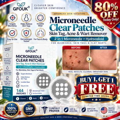 🧑‍⚕️𝐎𝐟𝐟𝐢𝐜𝐢𝐚𝐥 𝐒𝐭𝐨𝐫𝐞 | GFOUK®  🌿𝐁𝐨𝐭𝐚𝐧𝐢𝐜𝐚𝐥 𝐌𝐢𝐜𝐫𝐨𝐧𝐞𝐞𝐝𝐥𝐞 𝐇𝐲𝐝𝐫𝐨𝐜𝐨𝐥𝐥𝐨𝐢𝐝 𝐏𝐚𝐭𝐜𝐡 (𝐅𝐨𝐫 𝐒𝐤𝐢𝐧 𝐓𝐚𝐠𝐬, 𝐒𝐦𝐚𝐥𝐥 𝐒𝐤𝐢𝐧 𝐆𝐫𝐨𝐰𝐭𝐡𝐬, 𝐖𝐚𝐫𝐭𝐬, 𝐌𝐨𝐥𝐞𝐬, 𝐀𝐠𝐞 𝐒𝐩𝐨𝐭𝐬 & 𝐏𝐢𝐠𝐦𝐞𝐧𝐭𝐚𝐭𝐢𝐨𝐧 𝐂𝐨𝐧𝐜𝐞𝐫𝐧𝐬)