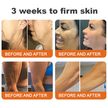 🌟💎 Rolimey® Bee venom Pro Comprehensive Cream —Tightening for Skin Types 🔥