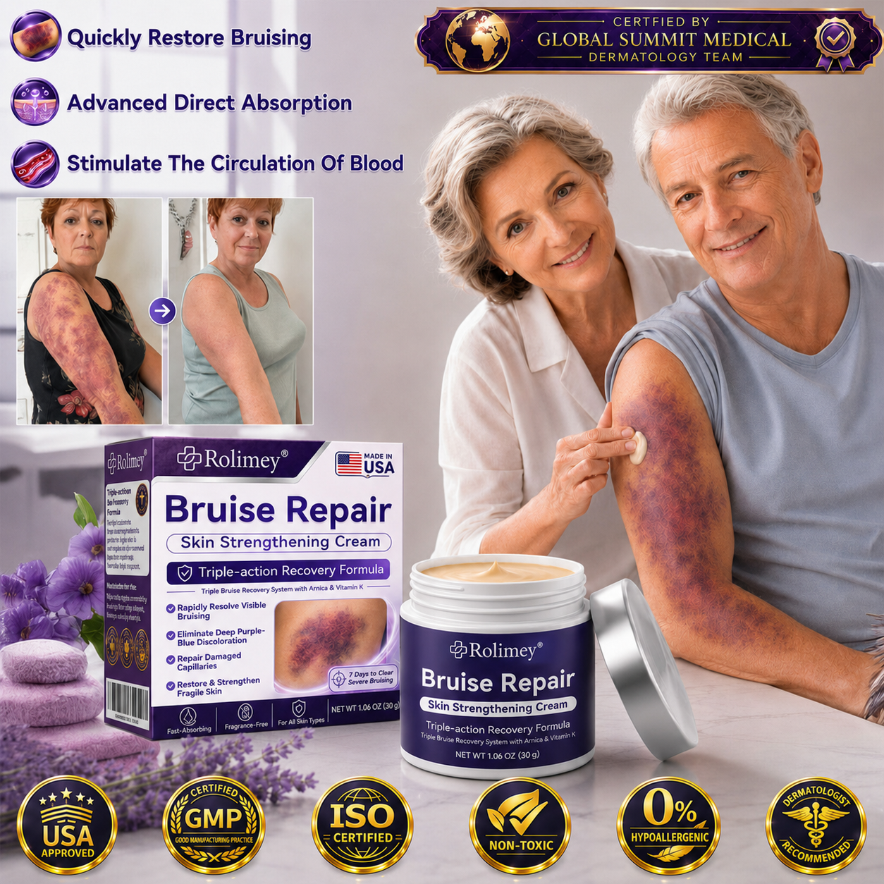 💫Over 100,000 units sold💕 - Rolimey® cream to repair bruises and strengthen the skin